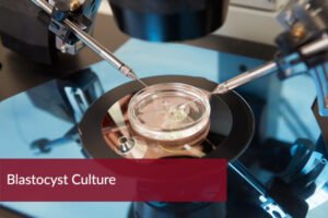 Blastocyst-Culture-in-india
